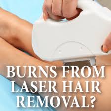 Strict sun protection is important to prevent pigmentation. Drs Severe Burns From Laser Hair Removal Is The Treatment For You