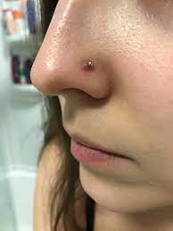 How Do I Get Rid Of This Bump On My Nose Piercing Piercing