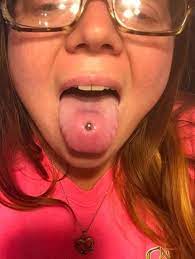 Normal For New Tongue Piercing Thriftyfun