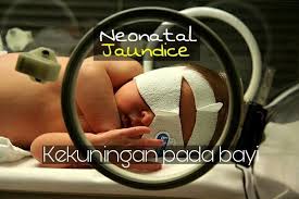 Memandangkan demam kuning kerap berlaku kepada bayi dan boleh menyebabkan kesan buruk, ia harus dititikberatkan. Kuning Bayi Jaundis Punca Faktor Risiko Dan Rawatan The Diagnosa