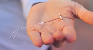 It's easy to start using nuvaring. Iud Vs Nuvaring What S The Difference