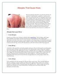 Find out everything you need to know about allergy testing. Calameo Allergies That Cause Hives