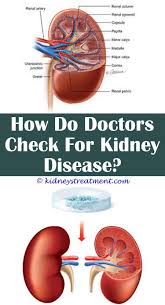 6 Auspicious Tips Kidney Infection Benefits Of Kidney Stones Vs Uti Kidney Ston Kidney Disease Recipes Kidney Disease Symptoms Kidney Failure Treatment