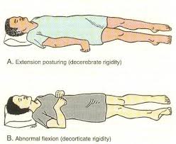 Pin On Neurology Module