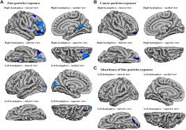 Brain test tricky puzzles level 312 walkthrough. Air Pollution Exposure During Fetal Life Brain Morphology And Cognitive Function In School Age Children Biological Psychiatry