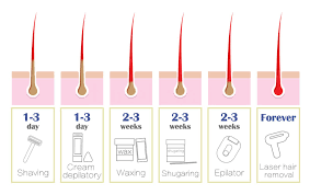 Can cause reactions, if you are allergic to some of the ingredients used within the hair removal cream similar to waxing or shaving, hair removal creams need to be used more often because hair can grow back just after a few days of use. Does Hair Removal Cream Make Hair Grow Back Thicker Kobo Guide