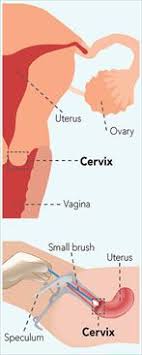 What is the next step? Cervical Cancer Screening My Doctor Online