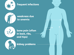People with mm develop tumors in their bone marrow, sometimes in more than one spot. Multiple Myeloma Overview And More