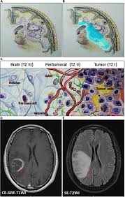 Infliximab, etanercept und adalimumab haben. Frontiers Therapeutic Potential Of Selenium In Glioblastoma Neuroscience