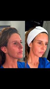 ✨2025 A Year Of Growth & Milestones! ✨Welcomed new team members: Rita  Sekula, NP Averey Rayborn Nicole Stewart 🏡Filled out the upstairs of our  beautiful office space. 🏆Introduced NEW Services & Products— …