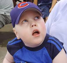 Carson Bowman Menkes Disease Story: 2010