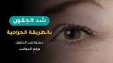 اثيكانا كلينك : مركز زراعة شعر وعمليات تجميل في تركيا - اسطنبول