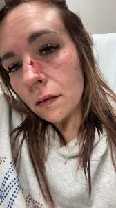 Hi @everyone, two days ago I had a gnarly fall. I promise to get to your  messages and orders asap. See below the post from my personal FB* First of  all,