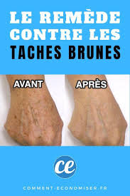 Epingle Sur Remedes Naturels