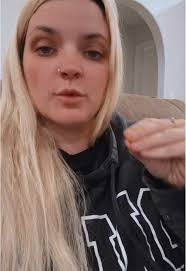 Chase Stapleton R Removal Cream Guy