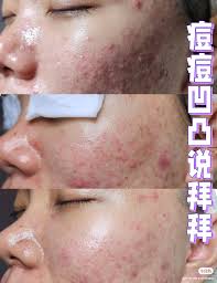 从头到脚打扮好💇🏻‍♀️💃🏻