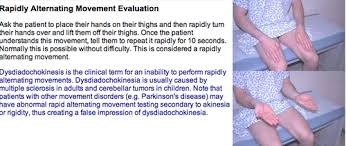 Image result for Rapid Alternating Movements