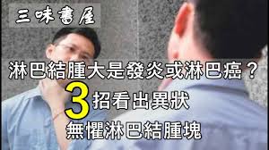 哪個細胞突變了？ b細胞型：較常見。罹患淋巴癌的犬貓中， 約有八成的狗和六成的貓是屬於此類型 。 t細胞型：雖然比例較低，但此類型的淋巴癌在治療上比較困難。 腫瘤長在哪？ æ·‹å·´çµè…«å¤§æ˜¯ç™¼ç‚Žæˆ–æ·‹å·´ç™Œ 3æ‹›çœ‹å‡ºç•°ç‹€ ç„¡æ‡¼æ·‹å·´çµè…«å¡Š ä¸‰å'³æ›¸å±‹ Youtube