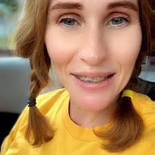 Fried potatoes and onions recipe with peanut oil