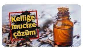 Sac Cikaran Yaglar Hair Loss Hair Loss Remedies Hair Loss Therapy