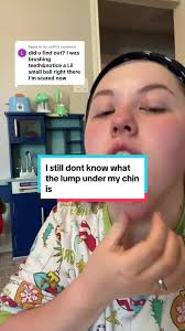 Replying to @no_se90 no i havent found out about the lump yet 😅👍  #medical#confusing#doublechin#lumps#bumps#lymphnode#tumor#growth#swollen#whoknows#doctor#fyp