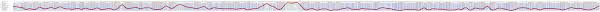 File used by jigs@w, a program used for creating and putting together puzzles; Pzp Gene Genecards Pzp Protein Pzp Antibody