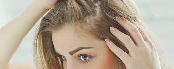 But rogaine's women's 5% minoxidil foam actually has. Best Hair Loss Treatment For Female Hair Regrowth For Women Cyber Hairsure