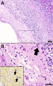 Streptococcus iniae challenge induces minimal acute histopathological  changes in Nile tilapia (Oreochromis niloticus) selectively bred for  disease resistance
