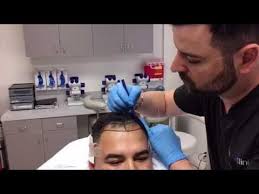 We've been treating hair thinning for 30 years. Hair Loss Hairlos19909553 Twitter