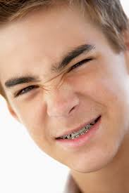 Maybe you would like to learn more about one of these? Does Attractiveness Of Orthodontic Appliances Affect Results