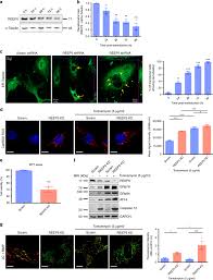 Maybe you would like to learn more about one of these? Reep5 Depletion Causes Sarco Endoplasmic Reticulum Vacuolization And Cardiac Functional Defects Nature Communications
