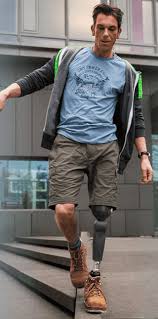 Dizustu Bacak Protezi Ozgur Irmak Protez Ve Ortez Merkezi