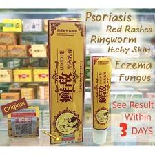 Psoriasis adalah keadaan kulit yang kompleks dan sering berulang dengan penyebab berlainan faktor. Psoriasis Eczema Cream Antifungal Antibacterial Itchy Cream Ubat Gatal Kurap Krim Ezcema Ekzema Ringworm Red Rashes å»¯ Shopee Malaysia