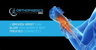 It often serves as a final treatment until the bone heals. Broken Wrist Fracture Trauma Treatment Dr Mike Smith Austofix Dr Chien Wen Liew Orthopaedic Surgeon Adelaide Orthopaedics 360