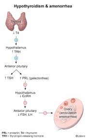 Image result for Hyperprolactinemia