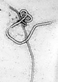 Transmission electron microscopy of the ebola virus daniel r. Ebolavirus Wikipedia