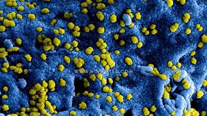 Canv (chrysosporium anamorph of nannizziopsis vriesii) is a fairly newly defined pathogen implicated in a fungal infection commonly known as yellow fungus disease. Wmptngah0nnmpm