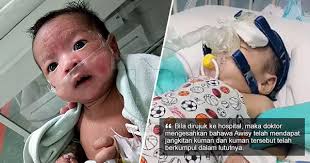 We did not find results for: Disentuh Dan Dicium Dari Situlah Awisy Mendapat Jangkitan Kuman Di Paru Paru Dan Darah The Reporter