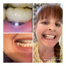 MICHAEL A PICCIONE, DDS