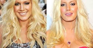 Celebrity Plastic Surgery Disasters Cbs News Patients travel from throughout the southeast to have dr. celebrity plastic surgery disasters