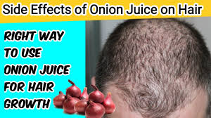 Celery juice benefits for fighting fatigue so many of us experience fatigue and celery and it's juice can help relieve you from fatigue. Right Way To Use Onion Juice For Hair Growth Side Effects Of Onion Juice On Hair Onion Juice Youtube