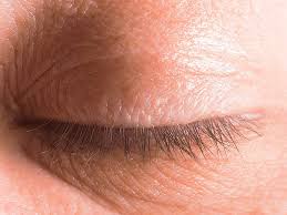 Image result for milium cyst on eyelid