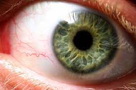 Gefassverschluss Im Auge Arterienverschluss Venenverschluss Netzhaut