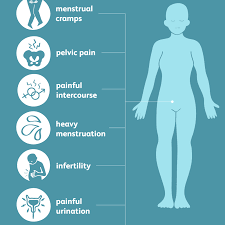 We did not find results for: Symptoms Of Endometriosis