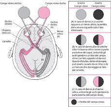 Le memorie nel petto riaccendi, ci favella del tempo che fu! Perdita Della Vista Improvvisa Disturbi Oculari Manuale Msd Versione Per I Pazienti