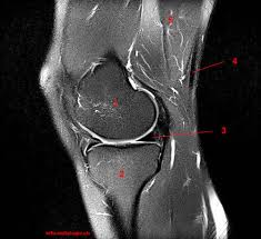 Click on the links to show each structure. Atlas Of Knee Mri Anatomy W Radiology