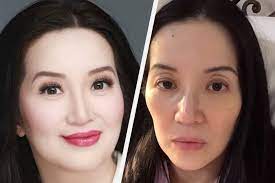 Dubbed as philippine's queen of all media, aquino has hosted numerous talk shows and game shows, starred in several films and television. After Losing 15 Pounds In A Month Kris Reveals Being Diagnosed With This Disease Abs Cbn News