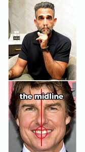 A seemingly impossible mission made possible. His Mission started with some  Braces and ended with crowns and veneers. . . . #TomCruise #smiledesign  #cosmeticdentist #whiteteeth #smilemakeover #veneers ...