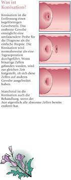 Pap Abstriche Verstehen Sie Ihre Befunde Pdf Free Download