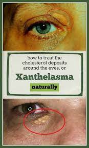 Pin On Natural Remedies
